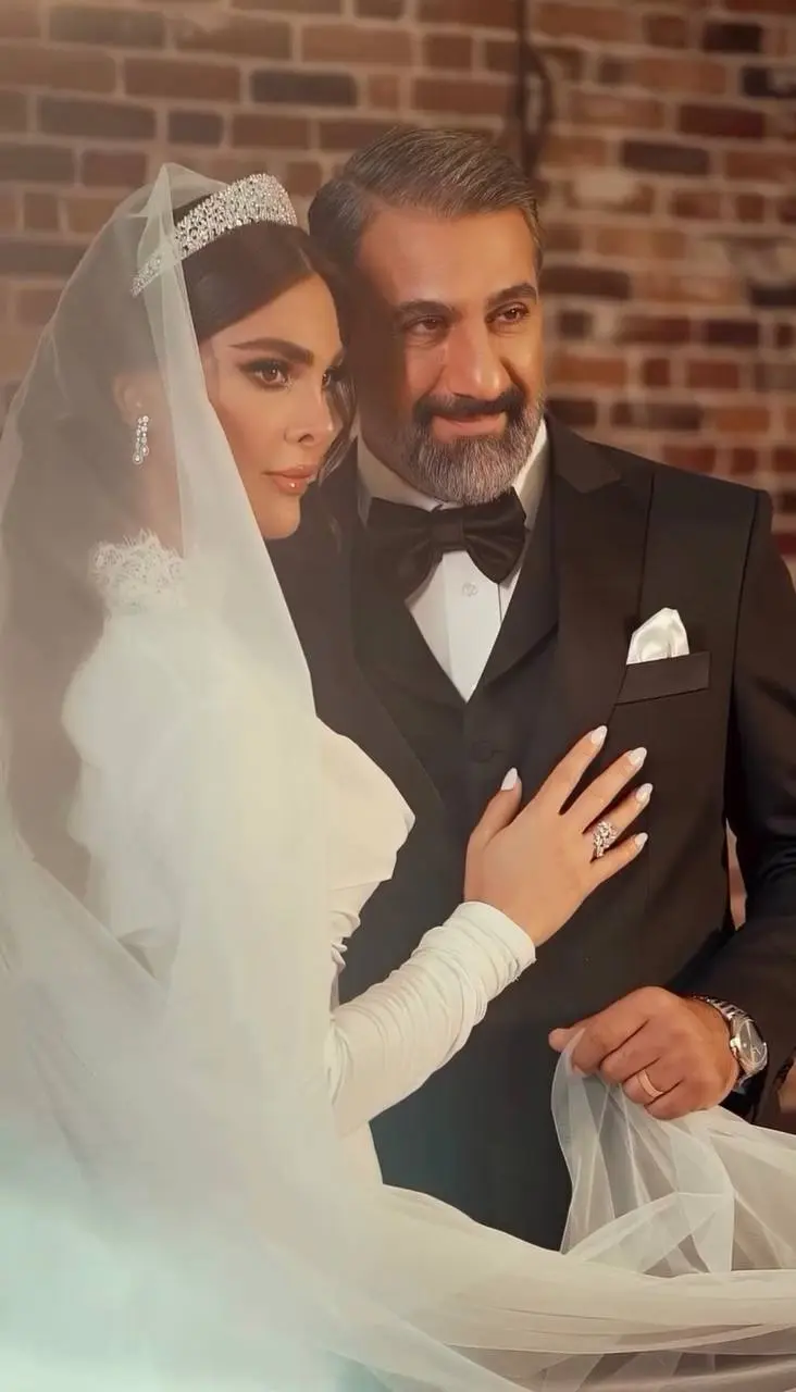 الناز
