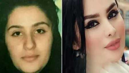 دنیا جهانبخت قبل از عمل