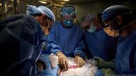 دست پزشک ایرانی در پیوند کلیه خوک به یک زن