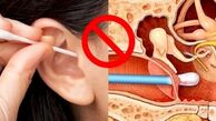 آیا می دانستید گوش‌پاکن‌های بازاری موجب آسیب به گوش می شوند؟