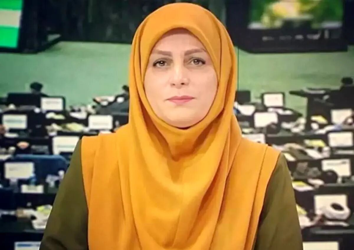 تغییر جنجالی چهره  مجری سابق شبکه خبر