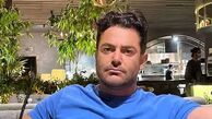 تغییر چهره رضا گلزار با زاویه صورت عجیبش + عکس تزریقات آقای بازیگر!