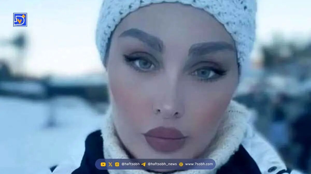 جنجال چهره واقعی طلا گلزار؛ زیبایی جعلی او در جشنواره کن دفن شد