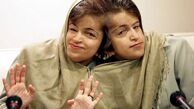 قصه زندگی لاله و لادن; خواهرانی با دو مغز و یک قلب+ عکس مزار
