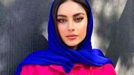 تغییر چهره عجیب ترلان پروانه