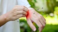 کدام گروه خونی برای پشه‌ها جذاب‌تر است؟