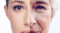 روش‌‌های ارزان جوان سازی پوست