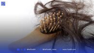 ۷ راهکار ساده و مؤثر برای جلوگیری از ریزش مو