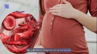 ضرورت مصرف مکمل آهن در بارداری