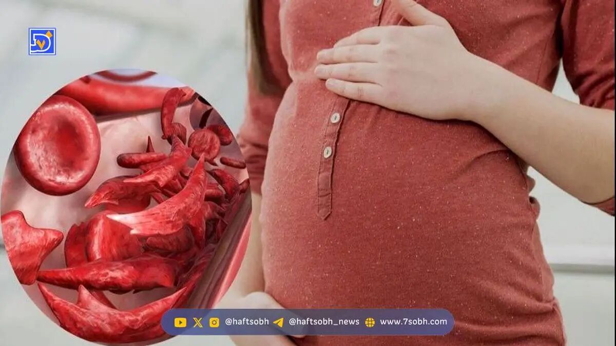 ضرورت مصرف مکمل آهن در بارداری