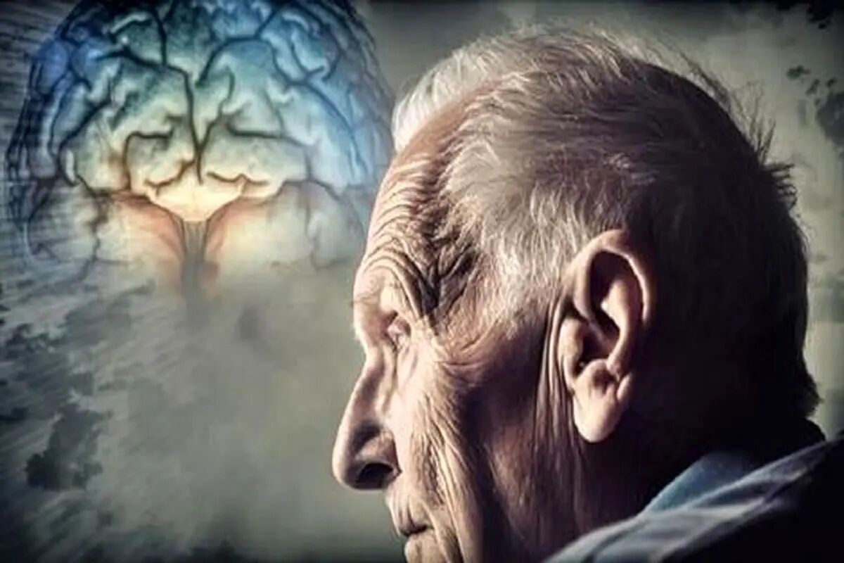 آلزایمر؛ واقعیتی رو به رشد در سالمندی