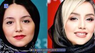 بررسی قبل و بعد چهره نازنین بیاتی «مریم سریال تاسیان» از گذشته تا امروز، ستاره محبوب چه جراحی‌هایی انجام داده؟