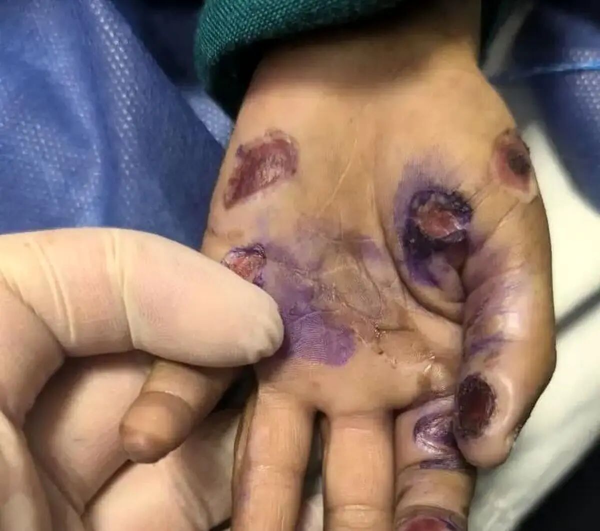 مرگ تلخ کودک 4 ساله بر اثر کودک آزاری