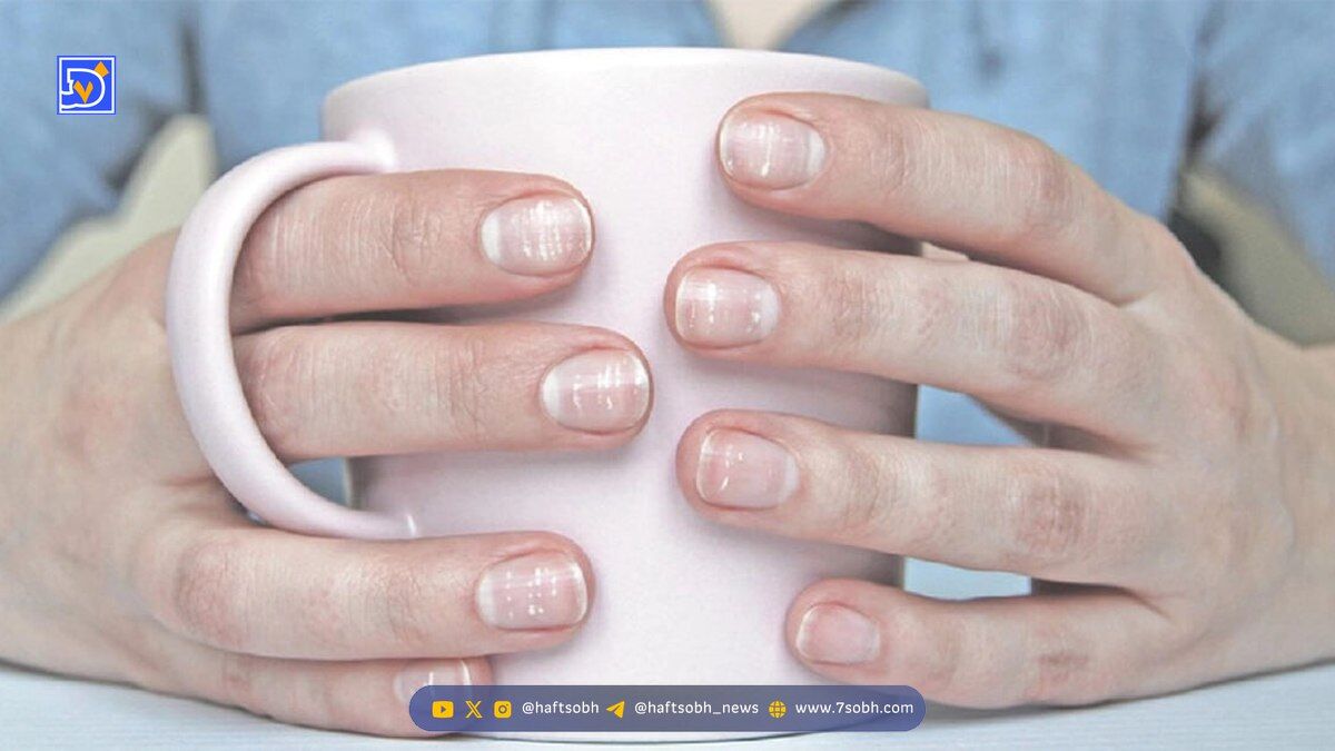 ویتامین کلیدی برای ناخن ها
