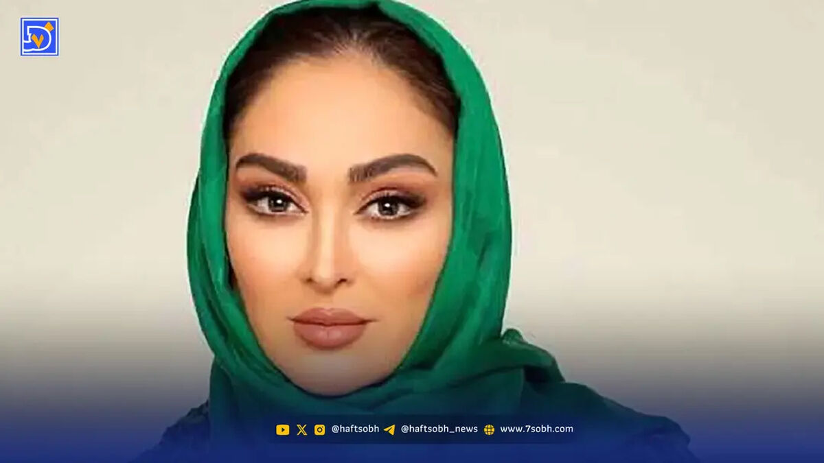 تغییر چهره جنجالی الهام حمیدی / عکس جدید خانم بازیگر و حیوان خانگی‌اش