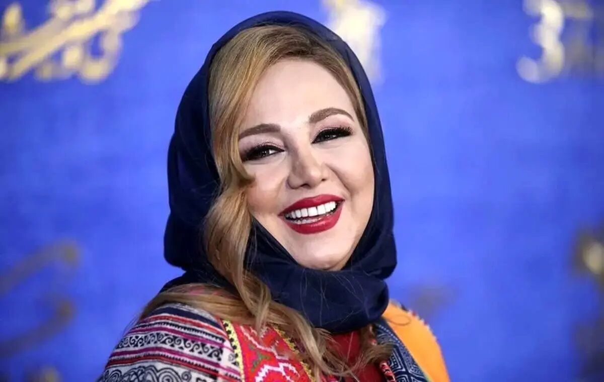 چهره «بهنوش بختیاری» در ماه های نخست تولدش